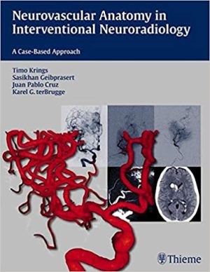 Neurovascular Anatomy in Interventional Neuroradiology A Case Based Approach