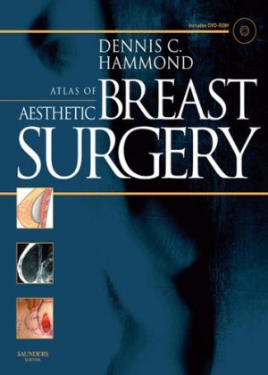 Atlas of Aesthetic Breast Surgery