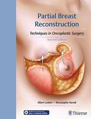 Partial Breast Reconstruction Techniques in Oncoplastic Surgery 2nd Edition