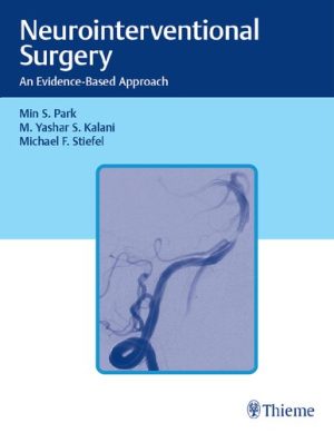 Neurointerventional Surgery An Evidence Based Approach