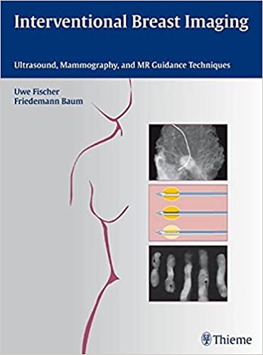 Interventional Breast Imaging Ultrasound Mammography and MR Guidance Techniques