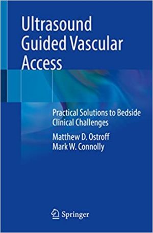 Ultrasound Guided Vascular Access