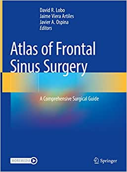 Atlas of Frontal Sinus Surgery A Comprehensive Surgical Guide
