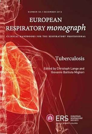 Tuberculosis By G B Migliori