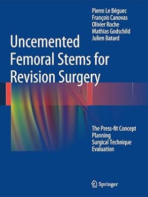 Uncemented Femoral Stems for Revision Surgery