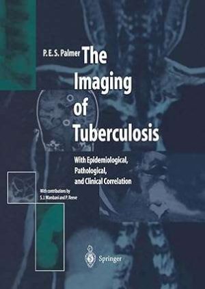 The Imaging of Tuberculosis With Epidemiological Pathological and Clinical Correlation