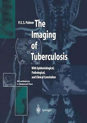 The Imaging of Tuberculosis With Epidemiological Pathological and Clinical Correlation