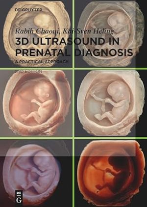3D Ultrasound in Prenatal Diagnosis A Practical Approach 2nd Edition