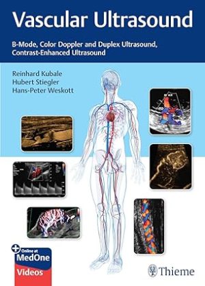 Vascular Ultrasound B Mode Color Doppler and Duplex Ultrasound Contrast-Enhanced Ultrasound