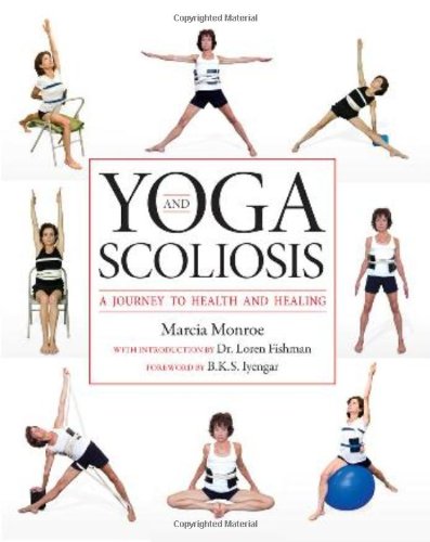 Yoga and Scoliosis A Journey to Health and Healing