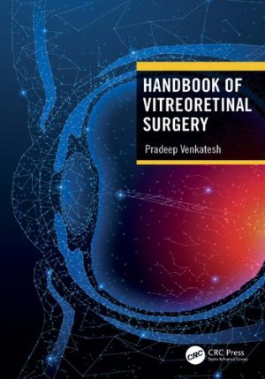 Handbook of Vitreoretinal Surgery