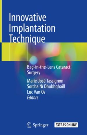 Innovative Implantation Technique Bag in the Lens Cataract Surgery