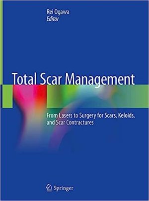 Total Scar Management From Lasers to Surgery for Scars Keloids and Scar Contractures
