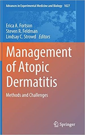 Management of Atopic Dermatitis Methods and Challenges