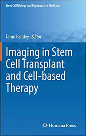 Imaging in Stem Cell Transplant and Cell based Therapy