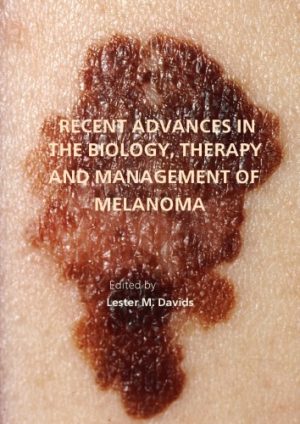 Recent advances in the biology therapy and management of melanoma