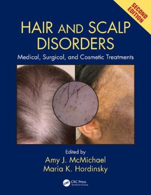Hair and Scalp Disorders Medical Surgical and Cosmetic Treatments 2nd Edition