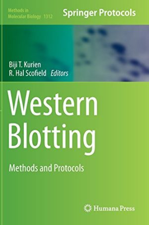 Western Blotting Methods and Protocols