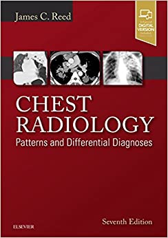 Chest Radiology Patterns and Differential Diagnoses 7th Ed
