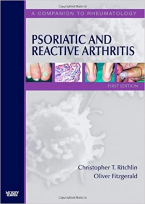 Psoriatic and Reactive Arthritis A Companion to Rheumatology