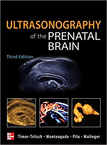Ultrasonography of the Prenatal Brain 3rd Edition