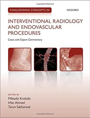 Challenging Concepts in Interventional Radiology