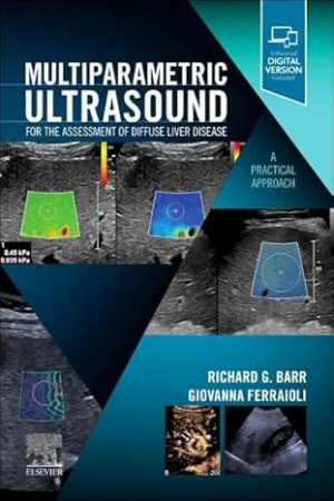 Multiparametric Ultrasound for the Assessment of Diffuse Liver Disease A Practical Approach