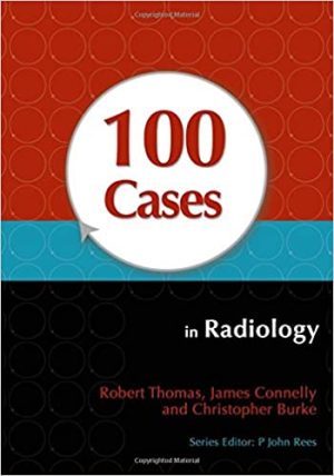 100 Cases In Radiology