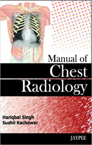 Manual of Chest Radiology