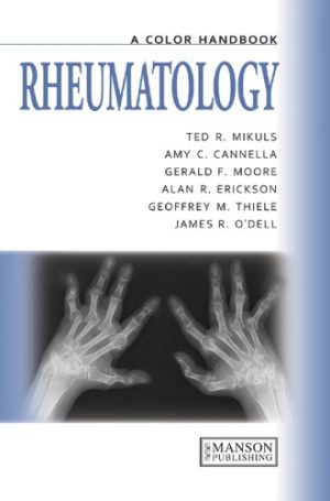 Rheumatology A Color Handbook