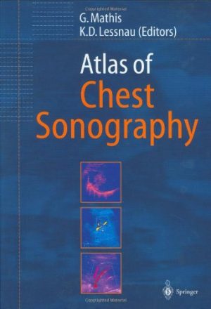 Atlas of Chest Sonography