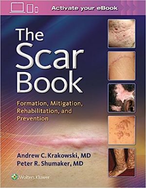 The Scar Book Formation Mitigation Rehabilitation and Prevention