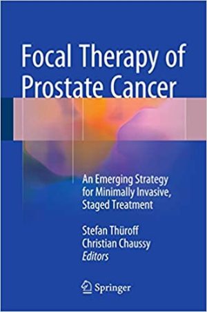 Focal Therapy of Prostate Cancer An Emerging Strategy for Minimally Invasive Staged Treatment