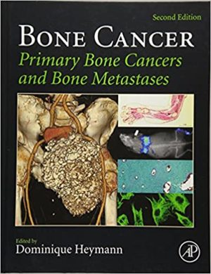 Bone Cancer Primary Bone Cancers and Bone Metastases 2nd Edition