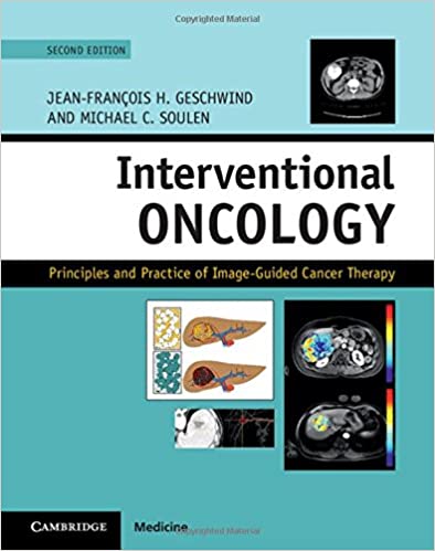 Interventional Oncology Principles and Practice of Image Guided Cancer Therapy 2nd Edition