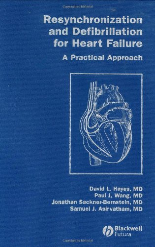 Resynchronization and Defibrillation for Heart Failure A Practical Approach