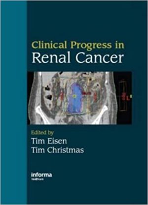Clinical Progress in Renal Cancer