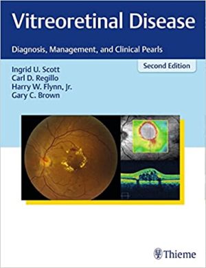 Vitreoretinal Disease Diagnosis Management and Clinical Pearls 2nd Edition