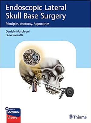 Endoscopic Lateral Skull Base Surgery Principles Anatomy Approaches