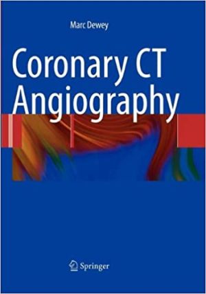 Coronary CT Angiography