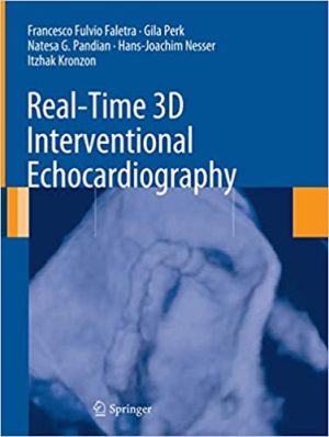 Real Time 3D Interventional Echocardiography