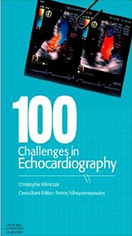 100 Challenges in Echocardiography