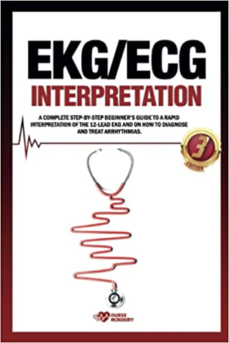 EKG ECG Interpretation