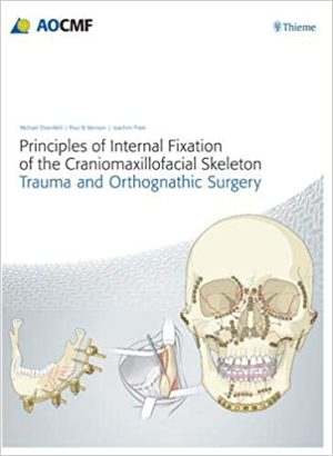 Principles of Internal Fixation of the Craniomaxillofacial Skeleton Trauma and Orthognathic Surgery