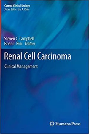 Renal Cell Carcinoma Clinical Management