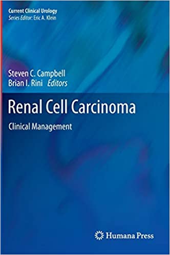 Renal Cell Carcinoma Clinical Management