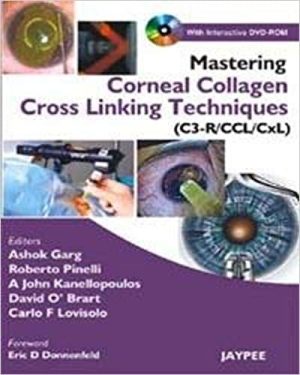 Mastering Corneal Collagen Cross linking Techniques