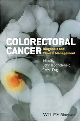 Colorectal Cancer Diagnosis and Clinical Management