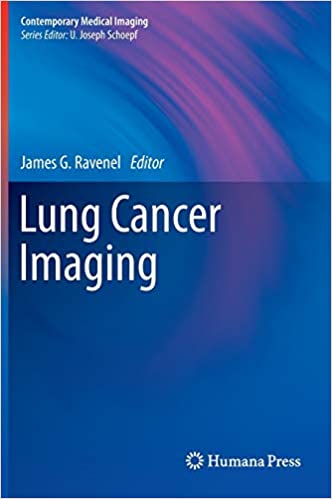 Lung Cancer Imaging
