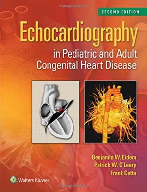 Echocardiography in Pediatric and Adult Congenital Heart Disease 2nd Edition